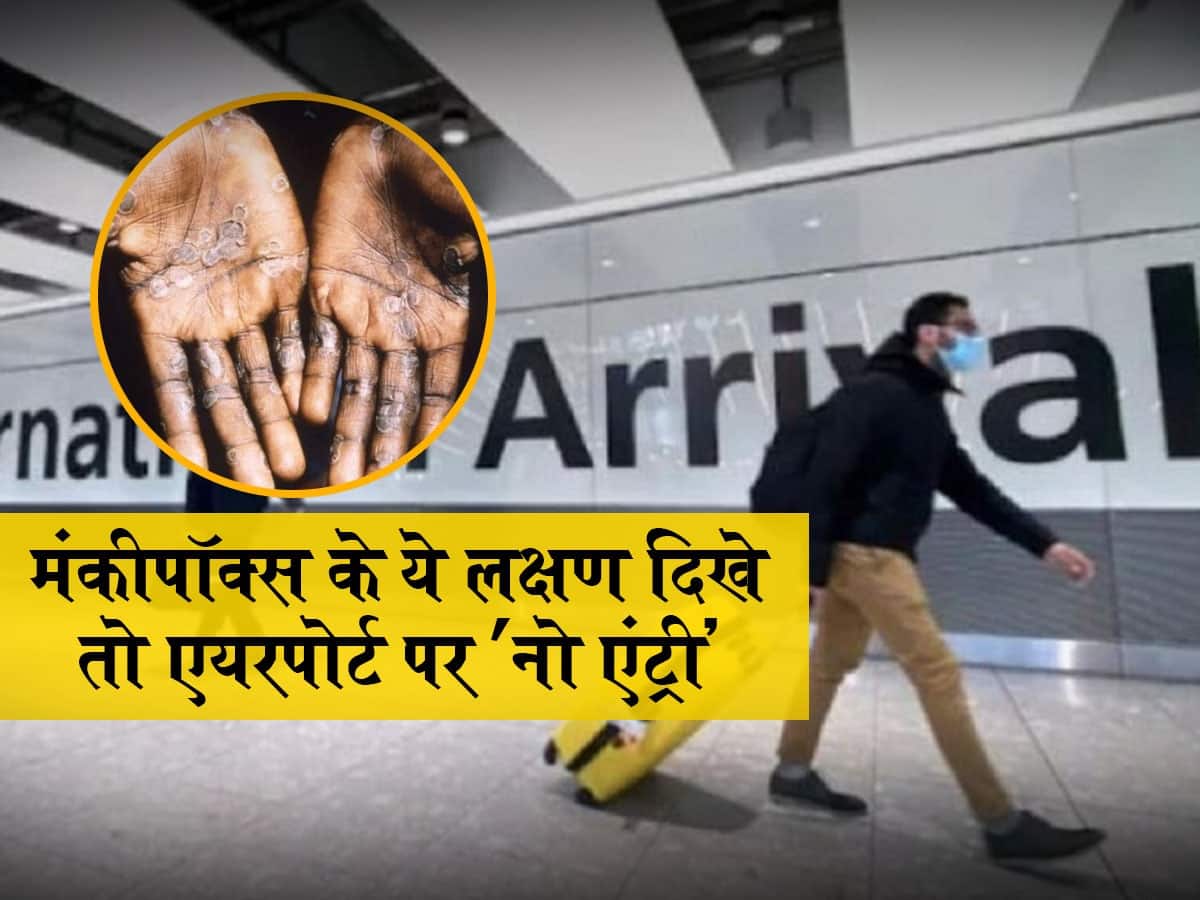 Monkeypox के ये 4 लक्षण दिखे तो एयरपोर्ट पर 'नो एंट्री', कोलकाता और तमिलनाडु ने जारी की स्पेशल एडवाइजरी